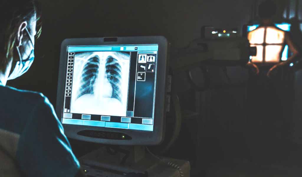 radiografía de torax